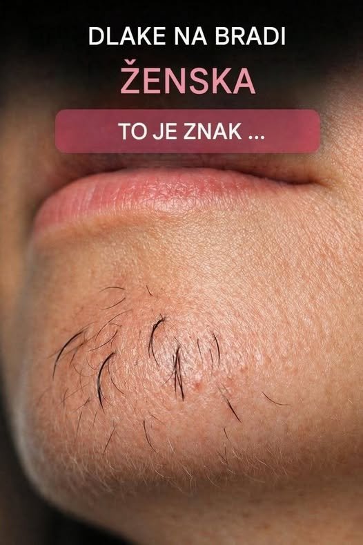 Dlake na ženski bradi: kaj lahko pomenijo in kdaj je potreben pregled? 783331377_1032156219635641_3923060531157935276_n