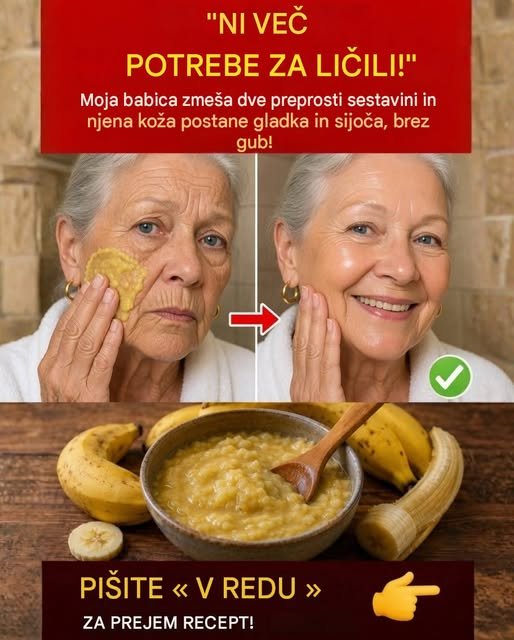 Naravna nega z banano in medom: preprosta domača maska za mehkejšo in bolj sijočo kožo 784816720_1408532431376884_2627747945593067122_n